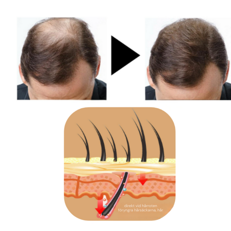 HairBoost™ | Inga kala fläckar längre!