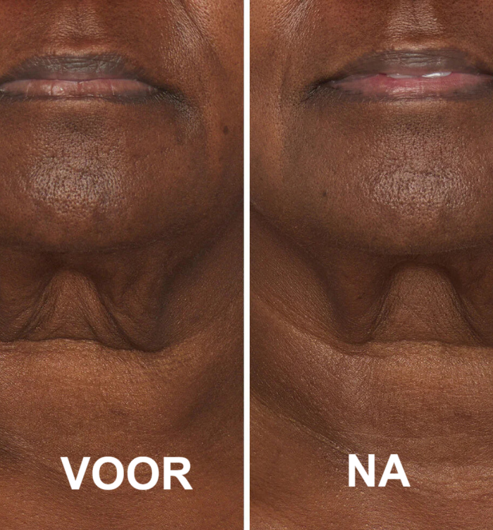 RevitaFirm™ | För en ungdomlig, fast hud!