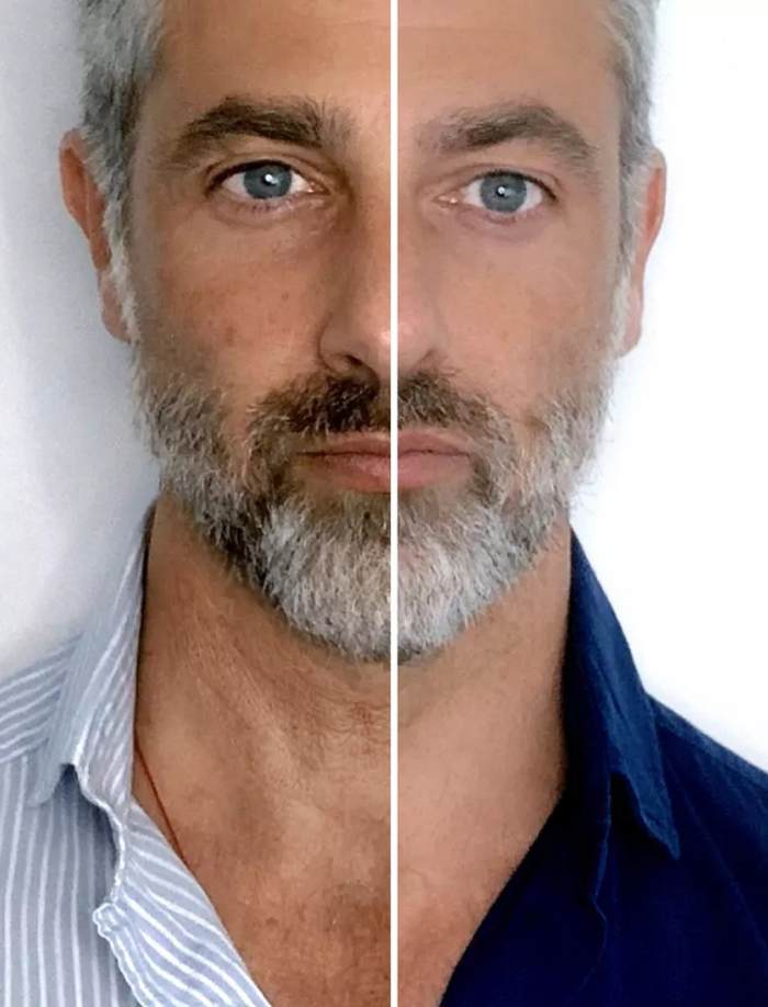 RevitaFirm™ | För en ungdomlig, fast hud!