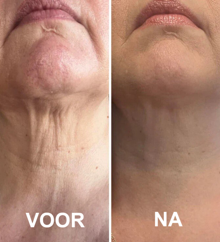 RevitaFirm™ | För en ungdomlig, fast hud!