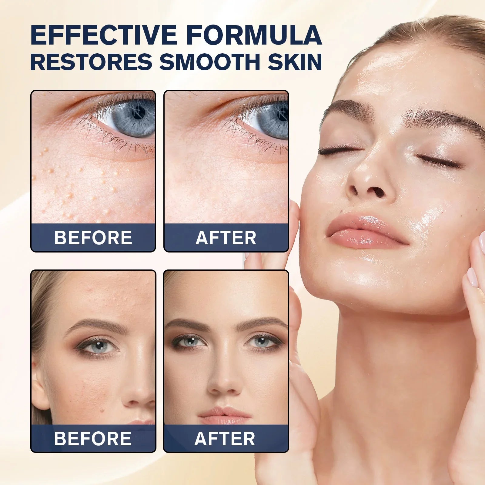 Milia™ | Resultat inom en vecka!