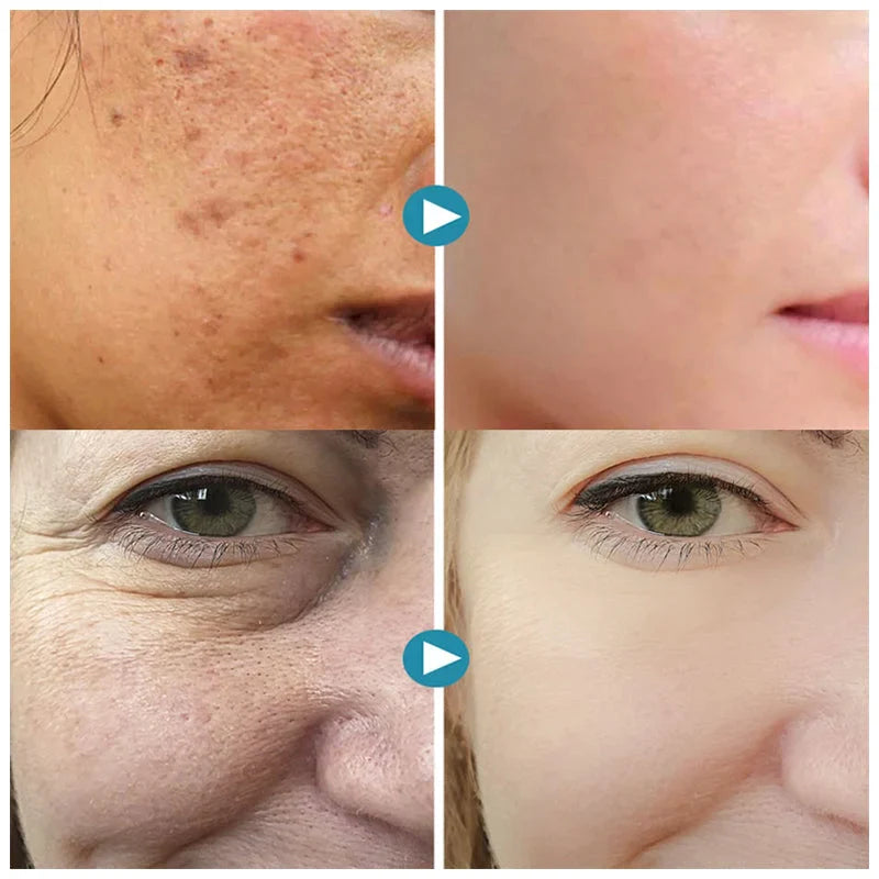 PureSkin™ | För ett strålande och fräscht ansikte
